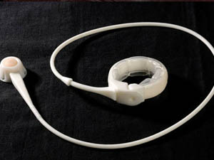 Gastric Band Reviews