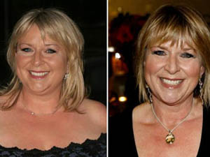 Fern Britton Gastric Band