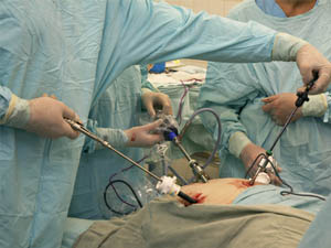 Gastric Band Surgery