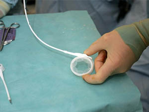 NHS Gastric Band Waiting List