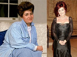 Sharon Osbourne Gastric Band